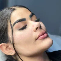 تزریق فیلر برای لب