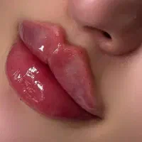 تزریق ژل ، لیزر ،بوتاکس