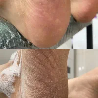 اسپا و پدیکور