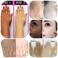 از تیرگی های صورت و بدنت خلاص شو