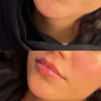 ژل لب متد M در ملایر