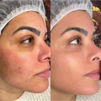 نیازمند دو مدل برای تکنیک پوست کرهای (هزینه مواد)|خدمات آرایشگری و زیبایی|ساری, |دیوار