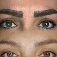 پاک کردن تاتو های قدیمی