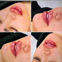 فیلر لب قیمت ویژه وهایفوتخفیف فوق العاده|خدمات آرایشگری و زیبایی|یزد, |دیوار