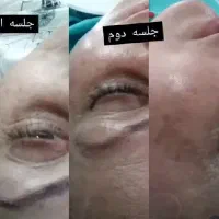 اسکین تراپیست|خدمات آرایشگری و زیبایی|شفت, |دیوار