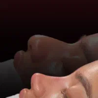 عمل زیبایی بینی/تهران/ولیعصر