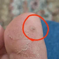 درمان|آرایشی، بهداشتی، درمانی|مشهد, کارمندان دوم|دیوار