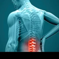 دررفتگی مهره های دیسک|خدمات پیشه و مهارت|نسیم‌شهر, |دیوار