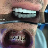 دندانپزشکی|خدمات آرایشگری و زیبایی|بروجرد, |دیوار