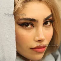 عمل جراحی بینی بادستگاه پیزوبدون درد،کبودی،خونریزی|خدمات آرایشگری و زیبایی|کرج, چهارصد دستگاه|دیوار