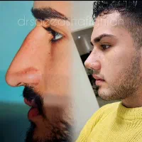 مشاوره و نوبت ویزیت رایگان بینی|خدمات آرایشگری و زیبایی|کرج, عظیمیه|دیوار