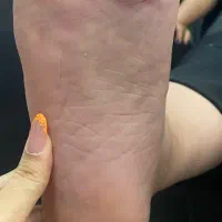 -رفع ترک و پینه پا با تکنیک تخصصی|خدمات آرایشگری و زیبایی|قائم‌شهر, |دیوار