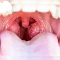 چوپچی یا همون قاروقچی