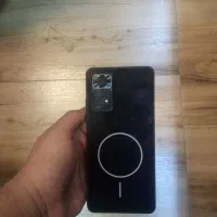 شیامی note 11 pro