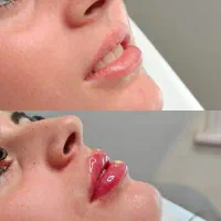 مدل ژل لب کانتورینگ و مدلینگ|خدمات آرایشگری و زیبایی|تهران, مرزداران|دیوار