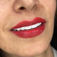 کامپوزیت دندان،روکش،لمینت،اموزش کامپوزیت|خدمات آرایشگری و زیبایی|فردیس, فردیس|دیوار