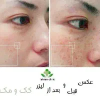 زیبائی