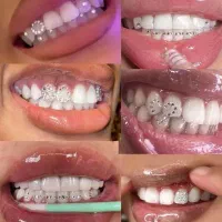 خدمات دندان پزشکی و دندان سازی|خدمات آرایشگری و زیبایی|زنجان, |دیوار