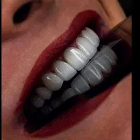 ارائه خدمات دندانپزشکی با شرایط اقساط