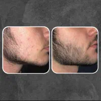 نتیجه فوق‌العاده‌ تضمینی