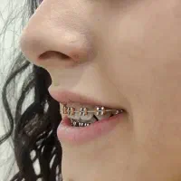 دندان پزشکی|خدمات آرایشگری و زیبایی|رشت, گلسار|دیوار