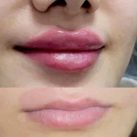 تخفیف تکرارنشدنی|خدمات آرایشگری و زیبایی|رشت, چله خانه|دیوار