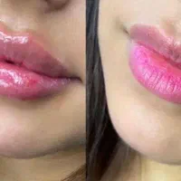 مدل برای آلبوم کاشت ناخن،پاکسازی صورت،کاشت مژه