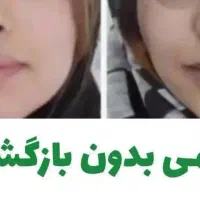 چاقی صورت به روش طبیعی