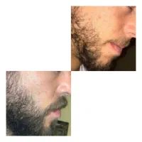 دیگه وقتشه یه رسیدگی به ریش موهات کنی