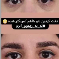 پرپشت شدن مو و رویش موی جدید|آرایشی، بهداشتی، درمانی|گناباد, |دیوار