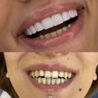 کامپوزیت آف ویژه|خدمات آرایشگری و زیبایی|بروجرد, |دیوار