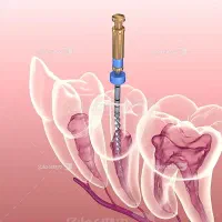 ارتودنسی عصب کشی روکش جراحی دندان عقل بدون ترس.|خدمات آرایشگری و زیبایی|زنجان, |دیوار