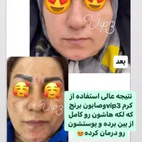 کرم وی آی پی اصلی|آرایشی، بهداشتی، درمانی|همدان, |دیوار