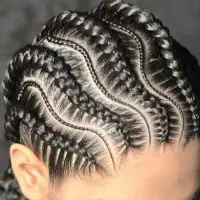 اپلاسیون و..