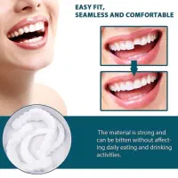 لمینت متحرک دندان|آرایشی، بهداشتی، درمانی|زابل, |دیوار