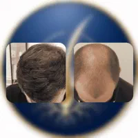 ۳بیل|آرایشی، بهداشتی، درمانی|تبریز, |دیوار
