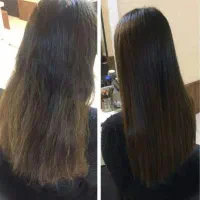 آفر ویژه موخوره گیری به روش روسی