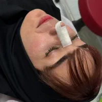 مراقبت های بعد از انواع جراحی ها و جراحی بینی