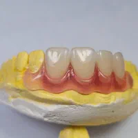 ساخت دندان مصنوعی تحویل یک روزفقط ۵میلیون|خدمات آرایشگری و زیبایی|زابل, |دیوار