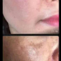 کرم سفید کننده شب (آنتی استاین )ترکیب آمپولی|آرایشی، بهداشتی، درمانی|بم, |دیوار