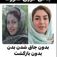 چاقی صورت بدون بازگشت