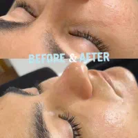 فیشال تخصصی پوست|خدمات آرایشگری و زیبایی|پرند, فاز ۵|دیوار