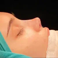 جشنواره عمل های زیبایی