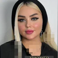 تزریق تخصصی ژل ومادلینگ وبوتاکس وهایفو درکلینیک|خدمات آرایشگری و زیبایی|کرمانشاه, |دیوار