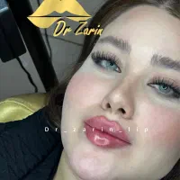 تزریق تخصصی فیلر لب بینی زیرچشم گونه زاویه فک چانه|خدمات زیبایی و سلامت|تهران, الهیه|دیوار