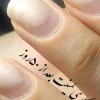 کاشت ۱۵۰تا۲۰۰|خدمات آرایشگری و زیبایی|نیشابور, امام|دیوار