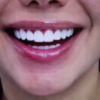 لبخندتو زیبا کنیم،هرچقدر میتونی بپرداز