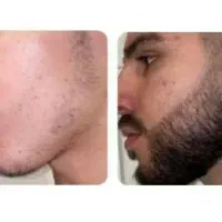 قدمی نو