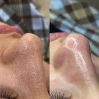 رنگ مو فیشیال دکلره موخوره گیری تخصصی