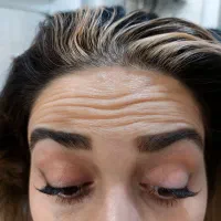 تزریق ژلوبوتاکس تخصصی در پرندبا نازلترین قیمت|خدمات آرایشگری و زیبایی|پرند, فاز ۲|دیوار